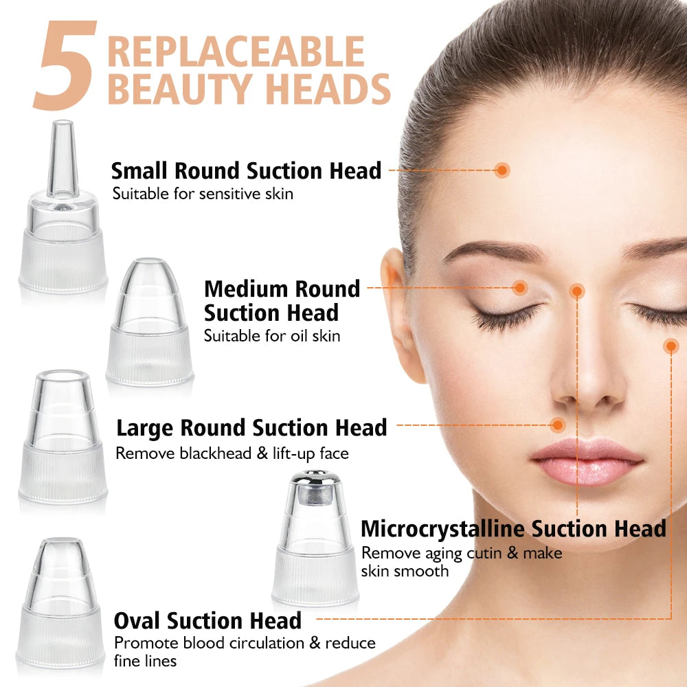 Blackhead Remover: 5-in-1 Vacuum Acne Cleansing System